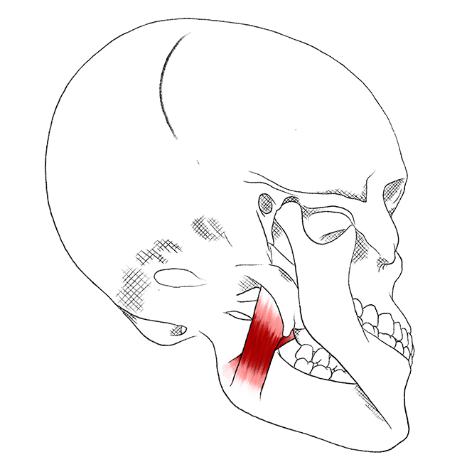 Músculo pterigoideo medial – Dolor y puntos gatillo